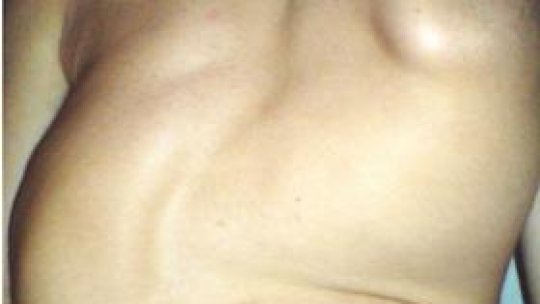 Ajutor pentru Călin și Anamaria !!!