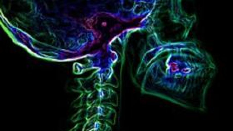 Radiografia în culori