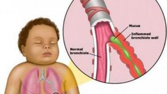 A început sezonul pentru profilaxia infecţiei cu virusul sinciţial respirator