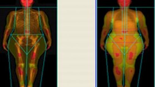 Peste un sfert dintre copiii spanioli sunt obezi