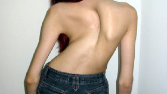 Premieră medicală la Bucureşti