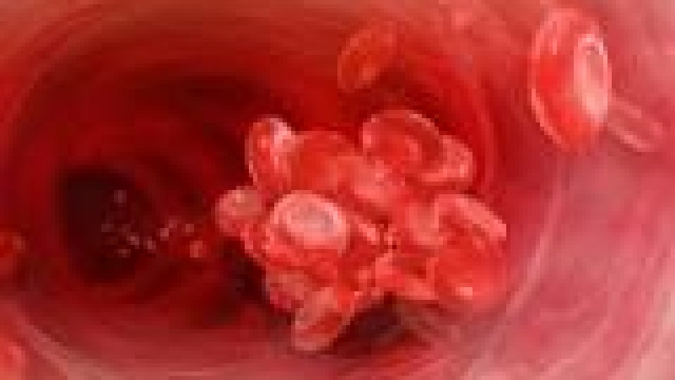 Analiză de sânge în premieră