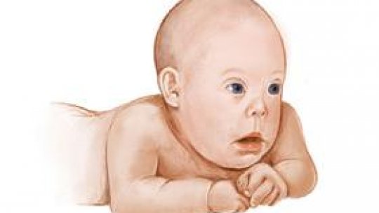 Posibilă cauză a Sindromului Down