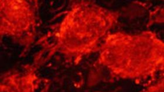 Campanie împotriva organismelor modificate genetic