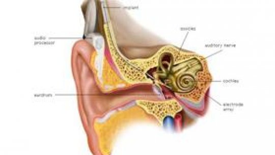 Implant cohlear la o fetiță de 11 ani