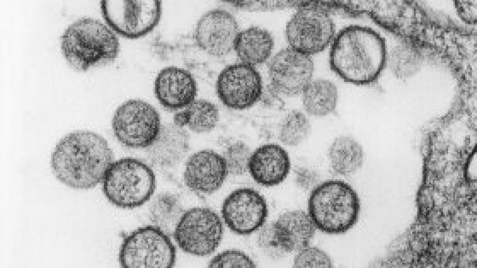 Virus mortal depistat în Parcul Naţional Yosemite din SUA