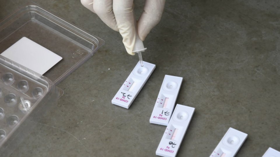 Un nou test de depistare a maladiei COVID-19 şi a anticorpilor