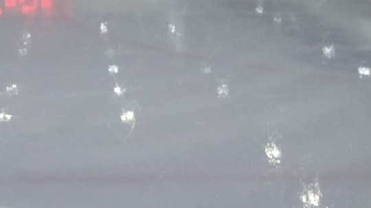 24 de oameni au alunecat pe gheață și au ajuns la Spitalul Floreasca din capitală în doar două zile