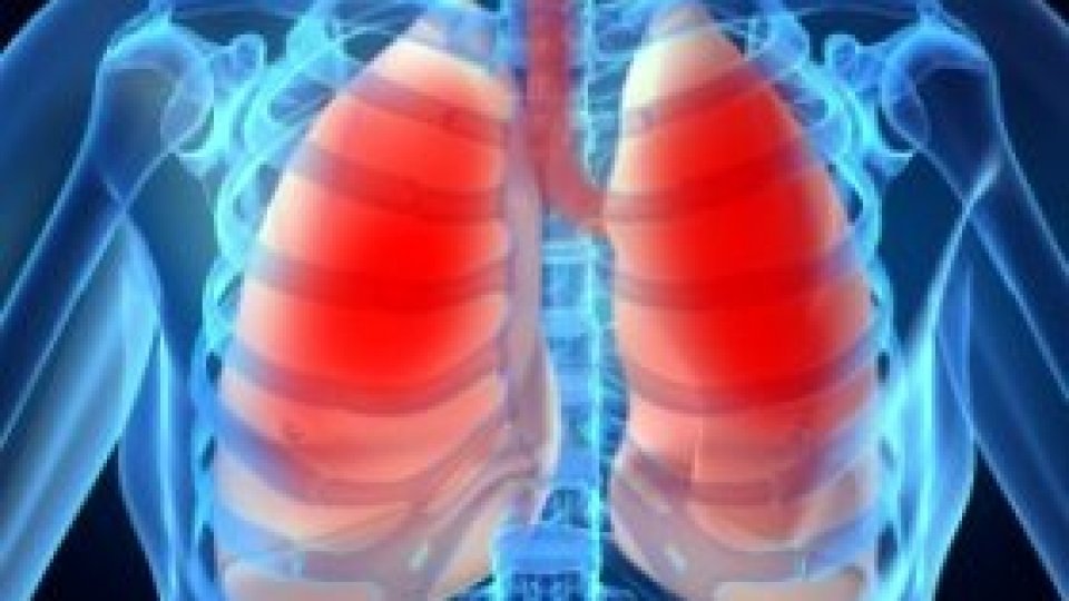 "Respiri Uşor", proiect pentru depistarea eventualelor boli pulmonare