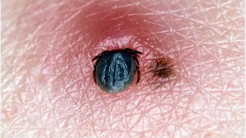 Olt: Tot mai multe persoane, înţepate de căpuşe