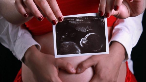 Ecografiile fără temei medical „nu sunt o distracție”