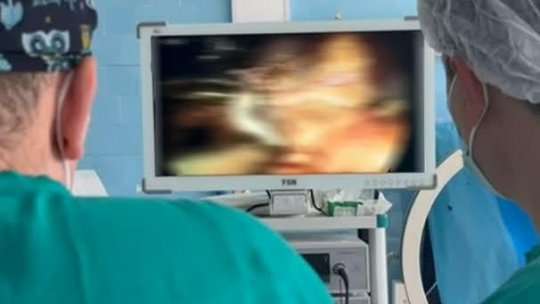 Premieră medicală la S.J. Galați: Prima operație laparoscopică de îndepărtare a unui rinichi